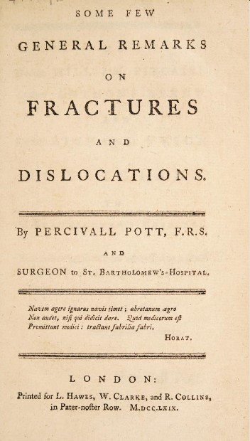 Llibre tractament de fractures Percivall Pott