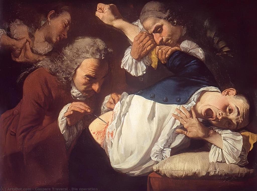 Apendicectomia Traversi