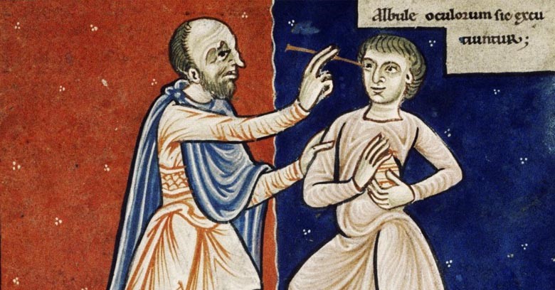 Miniatura medieval que representa la intervenció de cataractes amb la tècnica d'abatiment
