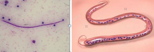 Microfilària a l'esquerra i filària a la dreta