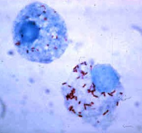 Bacils de R. Rickettsiae en cèl·lules hemo-limfàtiques de paparra.
