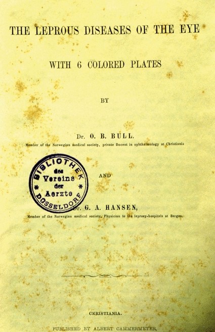 Portada del llibre escrit amb l'oftalmòleg Bull