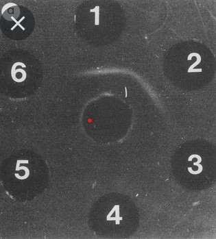 Dues línies de precipitació entre el pouet central i els pouets 1 i 2. Això indica, si en el pouet central hi ha l'antigen, que en els pouets 1 i 2 hi ha sèrum amb anticossos contra l'antigen.