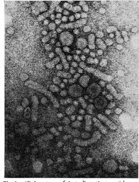 Microscòpia electrònica del sèrum d'un portador d'antigen Austràlia. Es veuen partícules víriques (o de Dane), i partícules petites, que corresponen a l'antigen Austràlia