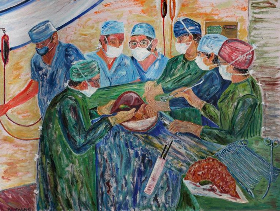 Trasplantament de fetge, pintat per Roy Calne, el 1988