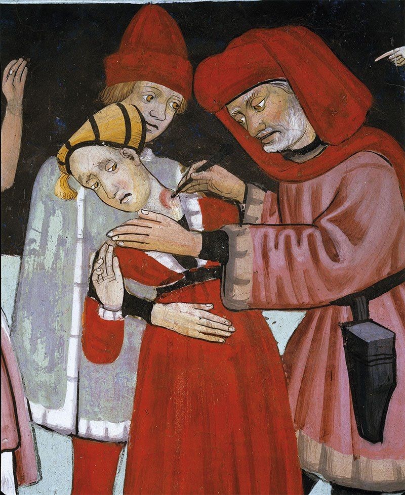 Metge medieval obrint un bubó del coll d'un malalt amb pesta. Fresc. Capella de Sant Sebastià. Lanslevillard (França)