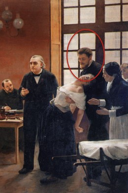 Fragment del quadre La lliçó de Charcot, en el que es veu a Babinski, l'ajudant de Charcot, sostenint la malalta que el professor presentava a classe