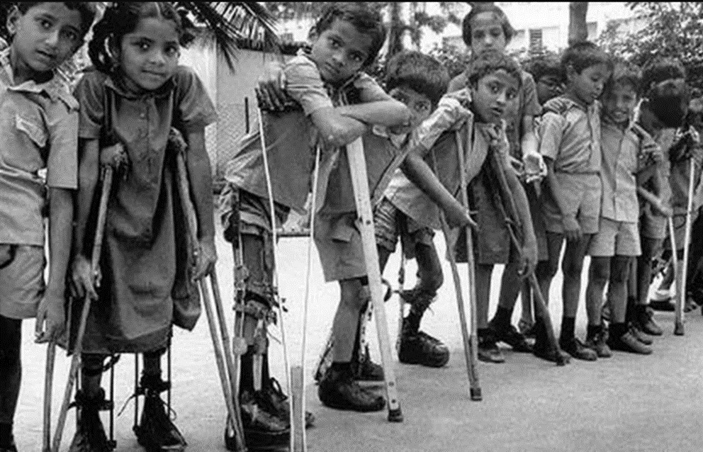 Nens amb poliomielitis