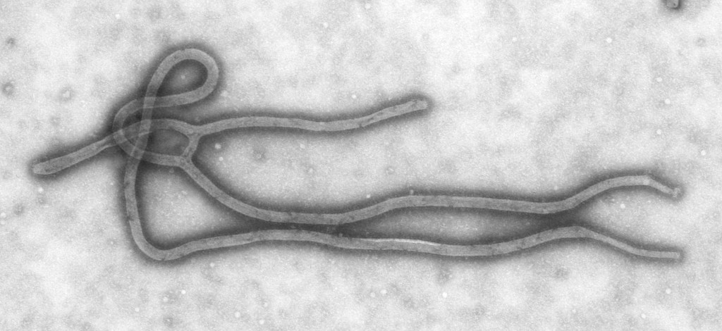 Microfotografia electrònica del virus Ebola