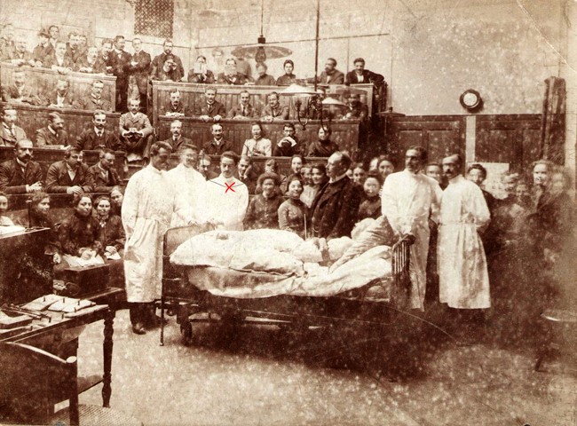 Joan Marimon Carbonell, assenyalat amb una x, ajudant del professor Theodor Kocher al costat del llit del pacient vestit de carrer, durant una classe de tècnica quirúrgica, a la Universitat de Berna, c. 1909