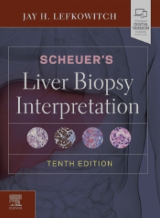 10ª edició del llibre de Scheuer, del que jo vaig estudiar-ne la 1ª