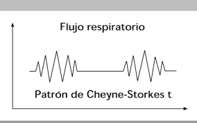Respiració de Cheyne - Stokes