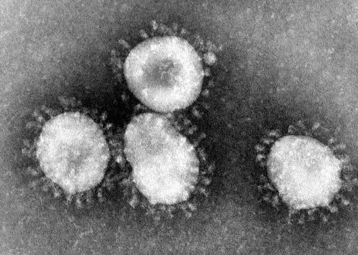 Coronavirus al microscopi electrònic. Les puntes (spikes) al voltant de la capa exterior és el que justifica el nom de coronavirus, ja que té l’aspecte d’una corona.