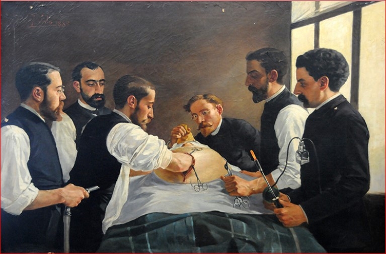 Operació del Dr. Miquel A. Fargas el 1885, pintada per J. Sala. MHMC. El quadre reuneix l’equip del Dr. Fargas, que actua com a cirurgià principal, i està rodejat dels seus ajudants. D’esquerra a dreta: Francesc Terrades -que té a les mans un aspirador-, el mestre Fargas, Miquel Carbó, l’anestesista Jeroni Estrany, Francesc Fàbregas -que té a les mans unes pinces NELATON- i Pau Torras que sosté el termocauteri.