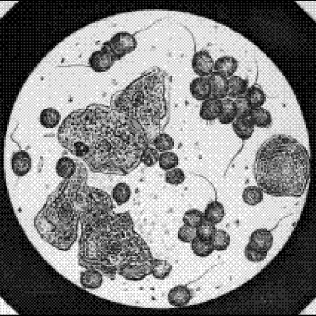 Daguerrotip de Tricomones vaginals