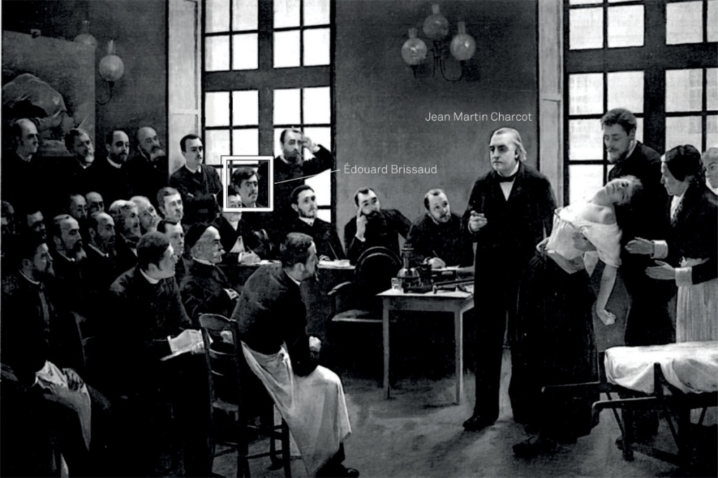 Edouard Brissaud escoltant atentament l'explicació de Charcot sobre la pacient que sosté el Dr. Babinski. Gilles de la Tourette és assegut davant de Charcot.