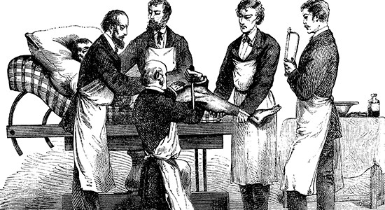 Cirurgians a punt de fer una amputació d'una cama amb les bates que es duien al primer terç del segle XIX