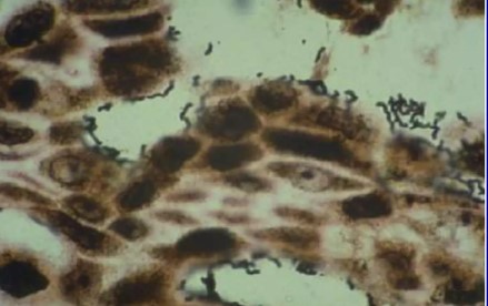 Tinció de plata que demostra bacils corbats enganxats a la mucosa gàstrica