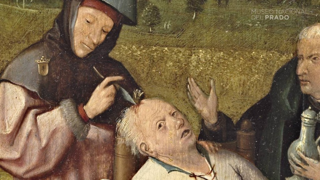 El cirurgià intenta una trepanació amb un bisturí. No extreu una pedra, sinó una flor.