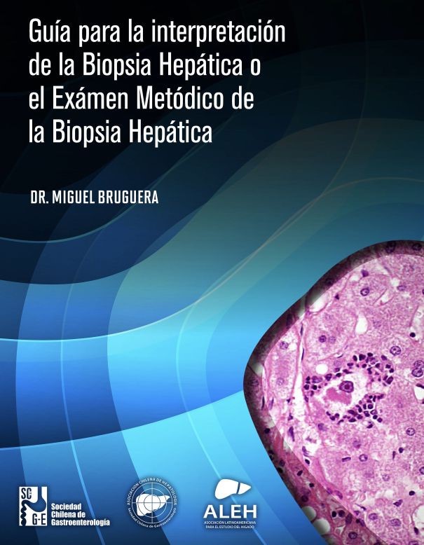 Llibre ”Interpretació de la biòpsia hepàtica”, assequible per internet
