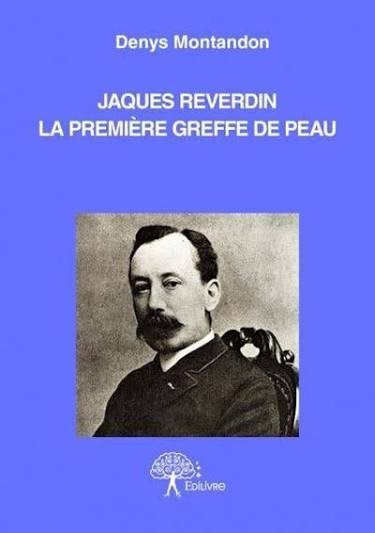Llibre sobre l'empelt cutani de Reverdin, el primer que s'ha fet al mon